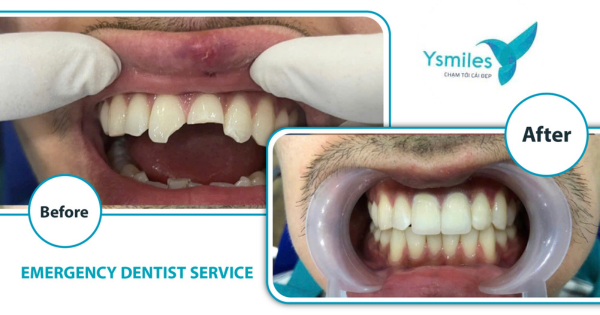 Nha khoa khẩn cấp