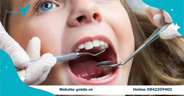 Nha Khoa Trẻ Em